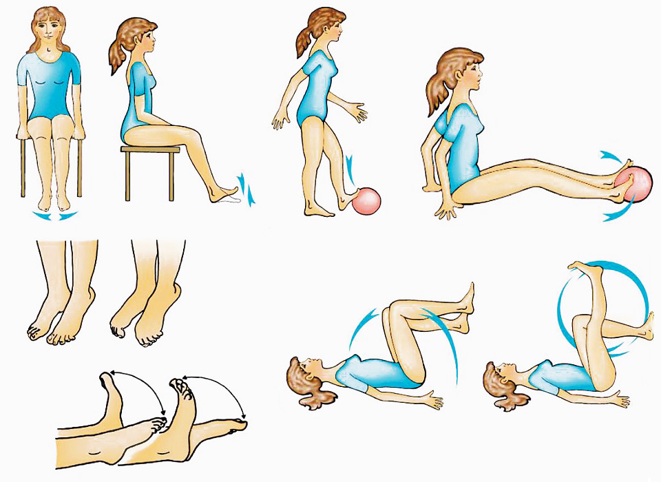 Exercises for prevention of varicose veins