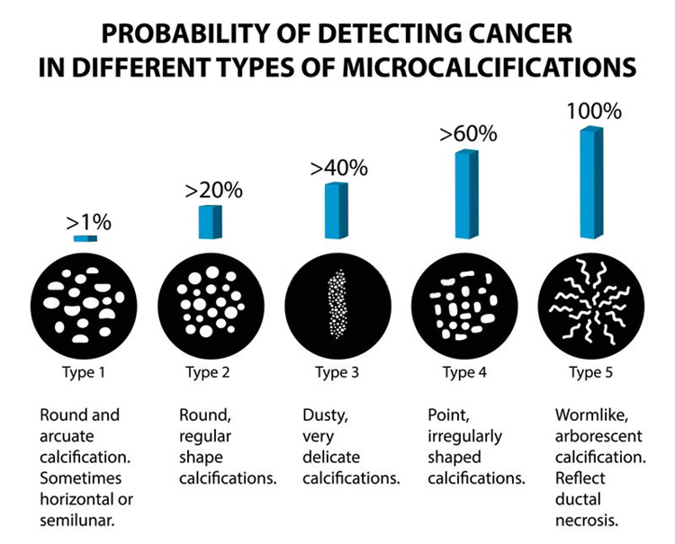 probability of detecting cancer