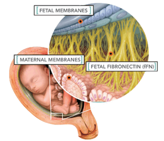 fetal fibronectin